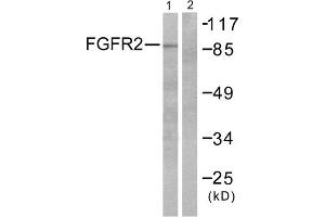 Western blot analysis of extracts from A549 cells, using FGFR2 antibody. (FGFR2 anticorps  (Internal Region))