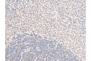 ABIN6255774 and ABIN6267285 at 1/100 staining rat spleen tissue sections by IHC-P. (ErbB2/Her2 anticorps  (pTyr1112))