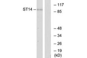 Western blot analysis of extracts from A549 cells, using ST14 Antibody. (ST14 anticorps  (AA 10-59))