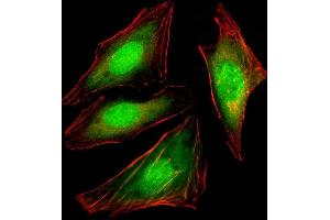 Immunofluorescent analysis of 4 % paraformaldehyde-fixed, 0.