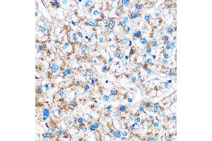 Immunohistochemistry of paraffin-embedded rat liver using Cathepsin B Rabbit pAb (ABIN3021175, ABIN3021176, ABIN3021177 and ABIN6214050) at dilution of 1:100 (40x lens). (Cathepsin B anticorps  (AA 1-339))