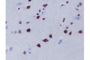 Immunohistochemical analysis of paraffin-embedded human brain, using HDAC9 Antibody.