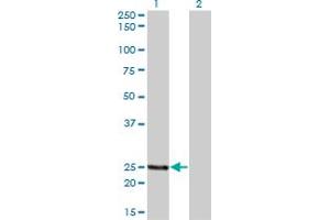 Western Blot analysis of PCTP expression in transfected 293T cell line by PCTP monoclonal antibody (M01A), clone 1F9. (PCTP anticorps  (AA 1-214))