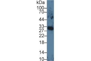 Detection of VEGF165 in Human Lung lysate using Monoclonal Antibody to Vascular Endothelial Growth Factor 165 (VEGF165) (VEGF 165 (AA 28-191) anticorps)