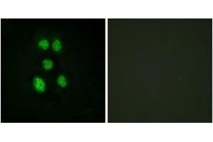 Immunofluorescence analysis of HeLa cells, using VAV1 (Ab-160) Antibody. (VAV1 anticorps  (AA 131-180))