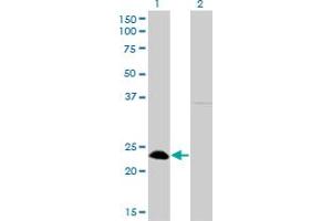 Western Blot analysis of NFYB expression in transfected 293T cell line by NFYB monoclonal antibody (M01), clone 6H6. (NFYB anticorps  (AA 1-207))