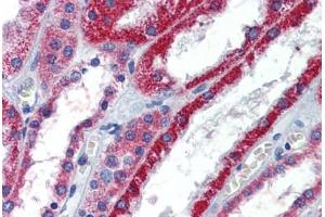 Human Kidney: Formalin-Fixed, Paraffin-Embedded (FFPE)