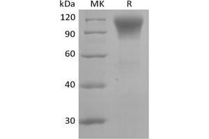Western Blotting (WB) image for Chemokine (C-C Motif) Ligand 20 (CCL20) protein (His tag) (ABIN7319932)