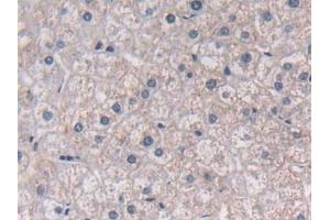 Detection of SEMA3E in Human Liver Tissue using Polyclonal Antibody to Semaphorin 3E (SEMA3E)