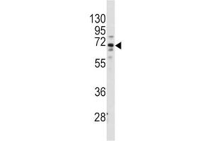Western Blotting (WB) image for anti-Frizzled Family Receptor 1 (Fzd1) antibody (ABIN3001613) (FZD1 anticorps)