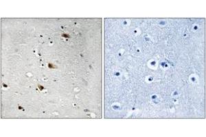 Immunohistochemistry analysis of paraffin-embedded human brain, using E2A (Phospho-Thr355) Antibody. (TCF3 anticorps  (pThr355))
