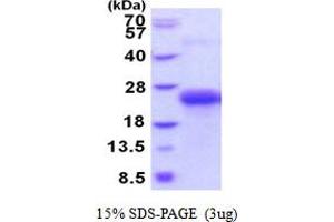 SDS-PAGE (SDS) image for C-Type Lectin Domain Family 1, Member B (CLEC1B) (AA 55-229) protein (His tag) (ABIN5854127) (C-Type Lectin Domain Family 1, Member B (CLEC1B) (AA 55-229) protein (His tag))
