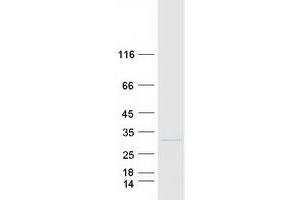 Validation with Western Blot