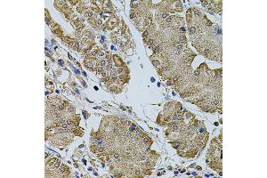 Immunohistochemistry of paraffin-embedded human stomach using CREBBP antibody (ABIN5974440) at dilution of 1/100 (40x lens). (CBP anticorps)