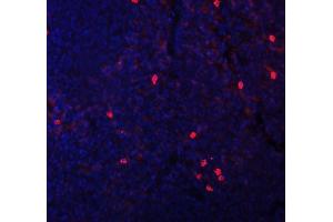 IF analysis of CXCL12 using anti-CXCL12 antibody (ABIN6719467).