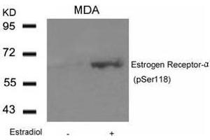 Image no. 3 for anti-Estrogen Receptor 1 (ESR1) (pSer118) antibody (ABIN196743) (Estrogen Receptor alpha anticorps  (pSer118))