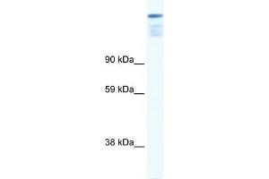 Human Muscle; WB Suggested Anti-ZFP106 Antibody Titration: 0. (ZFP106 anticorps  (N-Term))