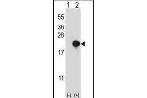 Western blot analysis of CYB5A (arrow) using rabbit polyclonal CYB5A Antibody (Center) (ABIN657954 and ABIN2846899).