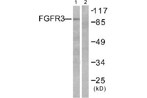 Western blot analysis of extracts from LOVO cells, using FGFR3 antibody. (FGFR3 anticorps)