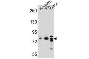 ARHGAP22 Antibody (C-term) western blot analysis in MDA-MB231,WiDr,ZR-75-1 cell line lysates (35µg/lane).