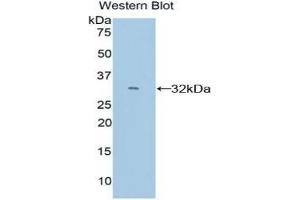 Western blot analysis of the recombinant protein. (CYP26A1 anticorps  (AA 250-495))