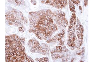 IHC-P Image Immunohistochemical analysis of paraffin-embedded SG xenograft , using CNGA2, antibody at 1:500 dilution. (CNGA2 anticorps  (C-Term))