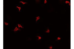 ABIN6269412 staining HeLa cells by IF/ICC. (SMAD2 anticorps  (Internal Region))