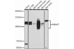 Western blot analysis of extracts of various cell lines, using HD Rabbit mAb (ABIN7267712) at 1:1000 dilution.