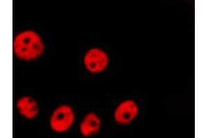 ABIN6266826 staining Hela by IF/ICC.