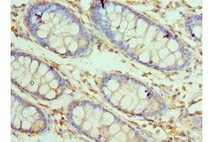 Immunohistochemistry of paraffin-embedded human colon tissue using ABIN7146923 at dilution of 1:100 (CARD8 anticorps  (AA 1-200))