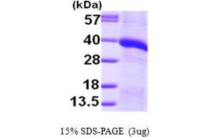 SDS-PAGE (SDS) image for Monoglyceride Lipase (MGLL) (AA 1-313) protein (His tag) (ABIN7279205)
