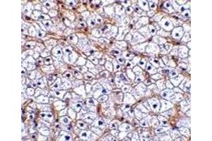 Immunohistochemistry (IHC) image for anti-Tumor Necrosis Factor Receptor Superfamily, Member 12A (TNFRSF12A) antibody (ABIN1031803) (TNFRSF12A anticorps)