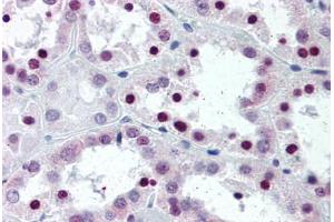 Human Kidney (formalin-fixed, paraffin-embedded) stained with SFRS1 antibody ABIN337068 at 5 ug/ml followed by biotinylated anti-mouse IgG secondary antibody ABIN481714, alkaline phosphatase-streptavidin and chromogen.