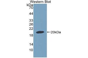 Western blot analysis of the recombinant protein. (GDF9 anticorps  (AA 306-440))
