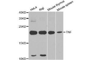 Western blot analysis of extracts of various cell lines, using TNF-α antibody. (TNF alpha anticorps)