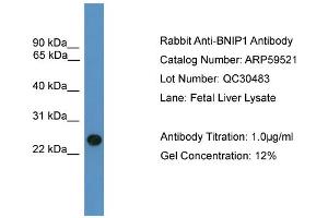 WB Suggested Anti-BNIP1  Antibody Titration: 0. (BNIP1 anticorps  (C-Term))