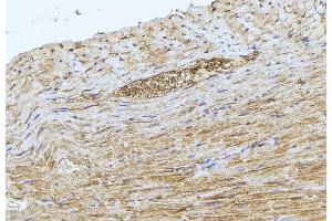 ABIN6277512 at 1/100 staining Mouse muscle tissue by IHC-P. (GCLM anticorps  (N-Term))