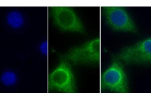 Detection of COX4I1 in Human Hela cell using Polyclonal Antibody to Cytochrome C Oxidase Subunit IV Isoform 1 (COX4I1)