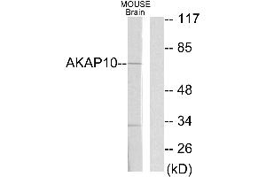 Western blot analysis of extracts from mouse brain cells, using AKAP10 antibody.