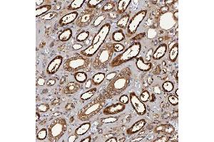 IHC analysis of SBP/SELENBP1 using anti-SBP/SELENBP1 antibody (ABIN7600755). (SELENBP1 anticorps  (AA 23-462))