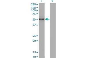 Western Blot analysis of ZSCAN21 expression in transfected 293T cell line by ZNF38 monoclonal antibody (M16), clone 4F10. (ZSCAN21 anticorps  (AA 136-224))
