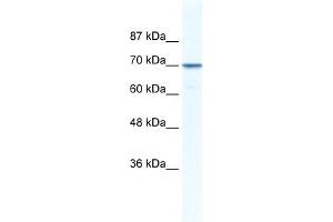 WB Suggested Anti-LAS1L Antibody Titration: 0. (LAS1L anticorps  (Middle Region))