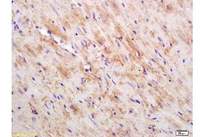 Formalin-fixed and paraffin embedded mouse heart labeled with Rabbit Anti CKMT/Creatine kinase MT Polyclonal Antibody, Unconjugated (ABIN717536) at 1:200 followed by conjugation to the secondary antibody and DAB staining (CKMT1B anticorps  (AA 115-220))