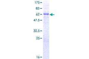 Image no. 1 for Paired Box 9 (PAX9) (AA 1-341) protein (GST tag) (ABIN1314091)