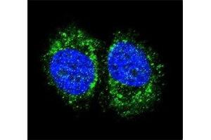Confocal immunofluorescent analysis of p65 antibody with MCF-7 cells followed by Alexa Fluor 488-conjugated goat anti-rabbit lgG (green).