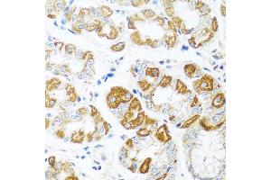 Immunohistochemistry of paraffin-embedded human stomach using CCL2 antibody (ABIN4903158) at dilution of 1:100 (40x lens). (CCL2 anticorps)