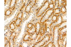 ABIN6256606 and ABIN6268850 at 1/100 staining Rat kidney tissue by IHC-P. (DCT anticorps  (N-Term))