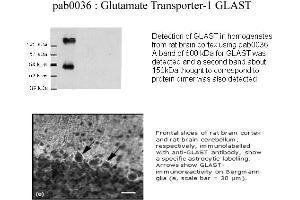 Image no. 1 for anti-Solute Carrier Family 1 (Glial High Affinity Glutamate Transporter), Member 3 (SLC1A3) (C-Term) antibody (ABIN346977) (SLC1A3 anticorps  (C-Term))