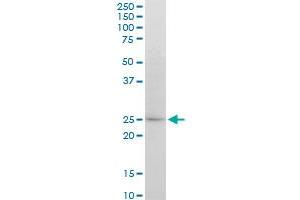 ATG5 monoclonal antibody (M04), clone 1G11. (ATG5 anticorps  (AA 176-275))