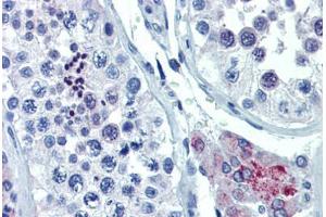 Human Testis (formalin-fixed, paraffin-embedded) stained with ASH2L antibody ABIN462194 followed by biotinylated goat anti-rabbit IgG secondary antibody ABIN481713, alkaline phosphatase-streptavidin and chromogen. (ASH2L anticorps  (AA 288-337))